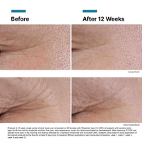 SkinCeuticals Treatments & Serums 1.0 fl. oz. SkinCeuticals P-TIOX Wrinkle Modulating Peptide Serum - Skin Type Solutions