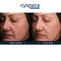 Cyspera Cyspera Original+ Pigment Corrector - Skin Type Solutions