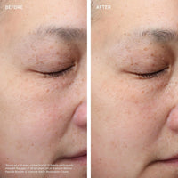 Aramore Treatments & Serums Aramore Retinol Peptide Boosting Serum - Skin Type Solutions