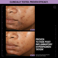 Allies Of Skin Treatments & Serums Allies of Skin Azelaic and Kojic Advanced Clarifying Serum - Skin Type Solutions