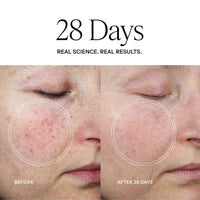 Exoceuticals Lotions & Moisturizers Exoceuticals Exo Plus Anti-Aging Cream - Skin Type Solutions