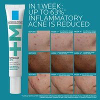 La Roche-Posay Treatments & Serums La Roche-Posay Effaclar BPO Multi-Target Acne Treatment - Skin Type Solutions