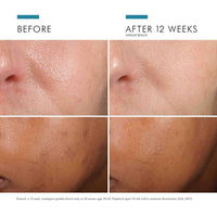 SkinCeuticals Facial Treatment 1.0 fl. oz. SkinCeuticals Phloretin CF - Skin Type Solutions