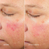 RescueMD Anti-Aging Skincare Kits RescueMD Skin Longevity Nighttime Oil - Skin Type Solutions