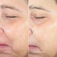 RescueMD Anti-Aging Skincare Kits RescueMD Skin Longevity Nighttime Oil - Skin Type Solutions