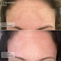 SENTE Facial Treatment 1.7 fl. oz. Sente Cysteamine HSA Pigment & Tone Corrector - Skin Type Solutions
