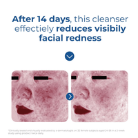 EltaMD SkinCare EltaMD Skin Recovery Amino Acid Foaming Cleanser - Skin Type Solutions