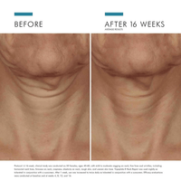 SkinCeuticals Body Moisturizer 50ml / 1.7 fl. oz SkinCeuticals Tripeptide-R Neck Repair - Skin Type Solutions