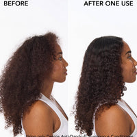 Vichy Scalp Treatment Vichy Anti-Dandruff Hydrating Scalp + Hair Conditioner - Skin Type Solutions