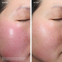 Aramore Treatments & Serums Aramore Retinol Peptide Boosting Serum - Skin Type Solutions