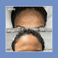 Cyspera Moisturizer Kits Cyspera Pigment Correction System - Skin Type Solutions