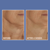 DefenAge Face & Body Treatment 1.5 fl. oz. DefenAge 6-week Perfection Neck Cream - Skin Type Solutions