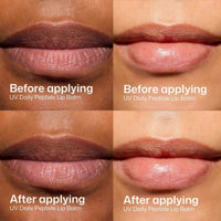 EltaMD UV Daily Peptide lip balm SPF 40 at skin type solutions before and after photos