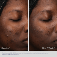 Obagi Obagi Retinol + PHA Refining Night Cream - Skin Type Solutions