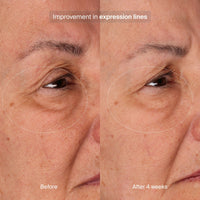 Pavise Eye Treatment Creams 1.0 oz. Pavise Bioadaptive Stress Repair - Skin Type Solutions