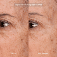 Pavise Eye Treatment Pavise Precision Eye Lift - Skin Type Solutions