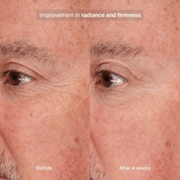 Pavise Eye Treatment Pavise Precision Eye Lift - Skin Type Solutions
