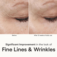Plated Skin Science Facial Moisturizer Plated SkinScience INTENSE Serum - Skin Type Solutions