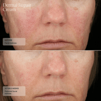 SENTE Facial Moisturizer 1.7 fl. oz. Senté Dermal Repair Cream - Skin Type Solutions