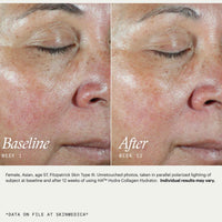 SkinMedica HA5 hydra collagen facial mist at skin type solutions before and after