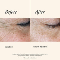 SkinMedica Facial Treatment 1 fl. oz. SkinMedica TNS Recovery Complex - Skin Type Solutions