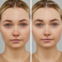 Jane Iredale Concealer Jane Iredale Purematch Liquid Concealer - Skin Type Solutions