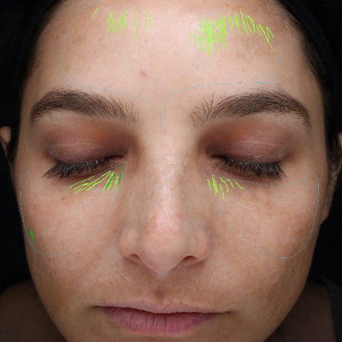 Skin analysis photo before her routine, April 4, 2024