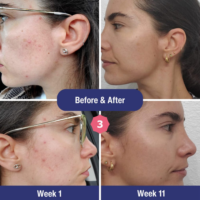 Before and after results