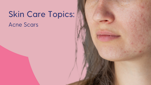 types of acne scars