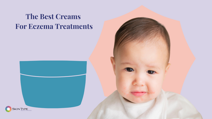 The best creams for eczema treatments