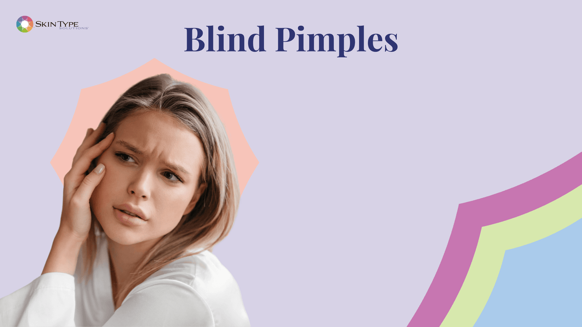 Blind pimple acne cyst hard lump under the skin