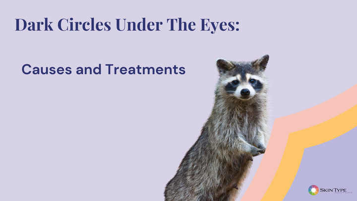 Dark circles under the eyes with a picture of a raccoon