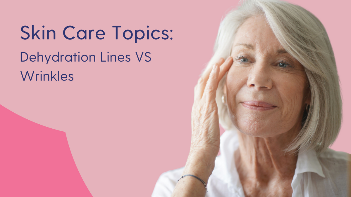 dehydration lines vs wrinkles