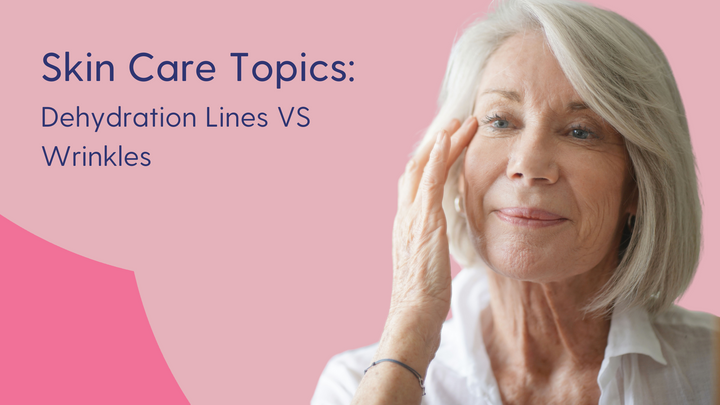 dehydration lines vs wrinkles