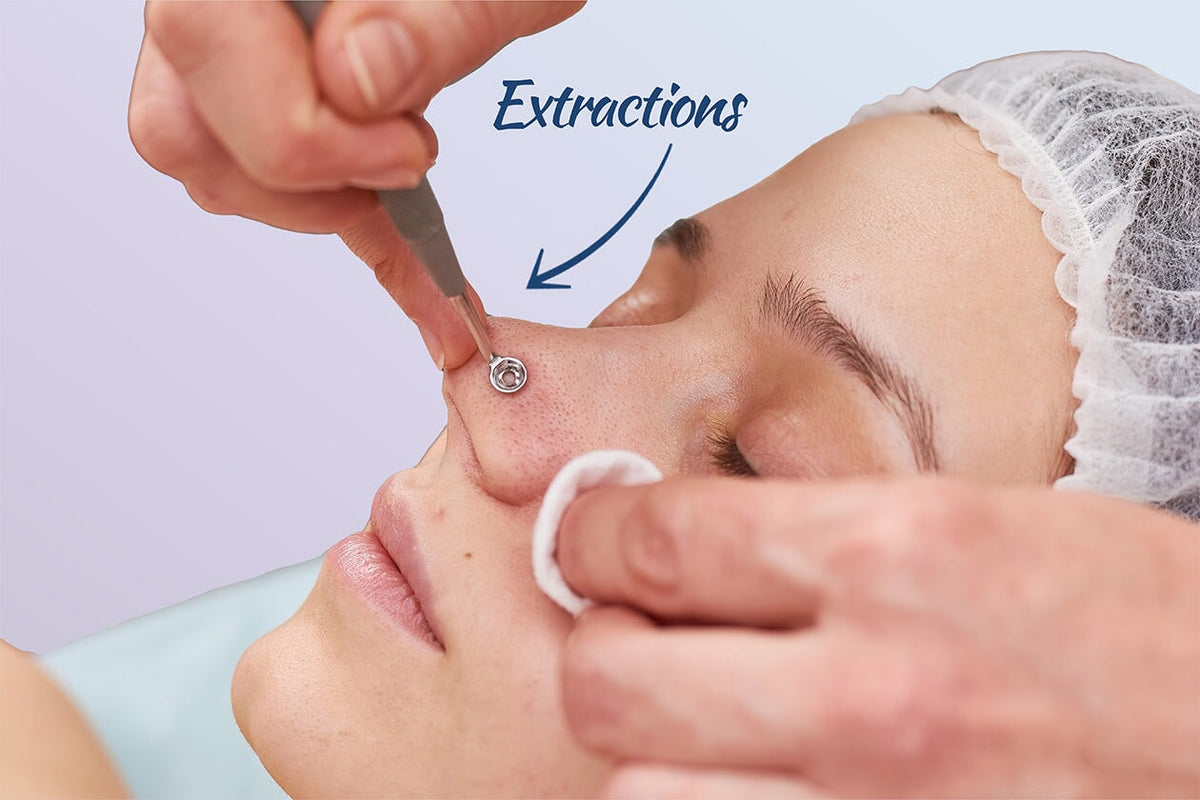 Facial Extractions