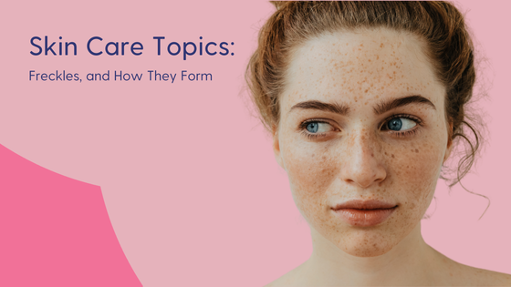 What are freckles and why do they form?