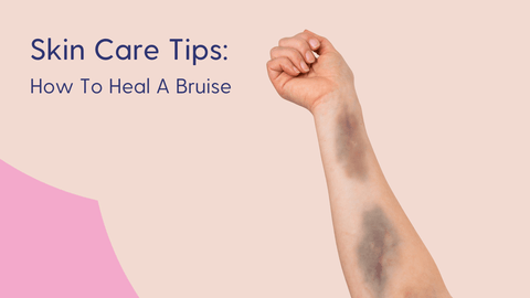 How to heal a bruise