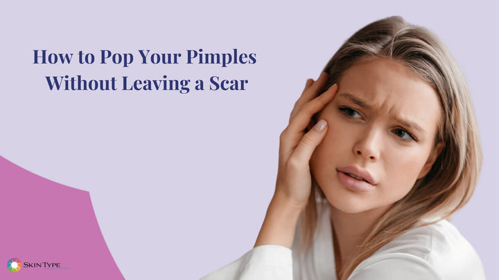 How to Pop a Pimple Correctly Without Leaving a Scar