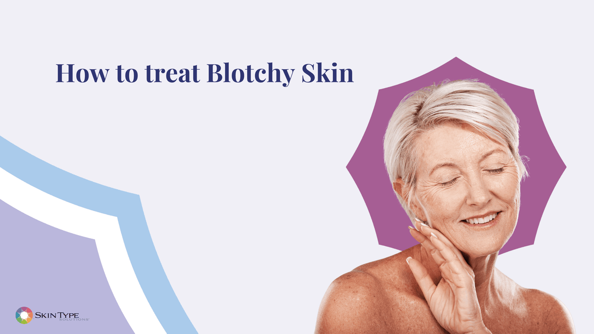 Splotvhy Rash Blotchy Skin