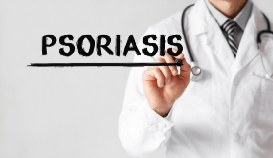 Psoriasis