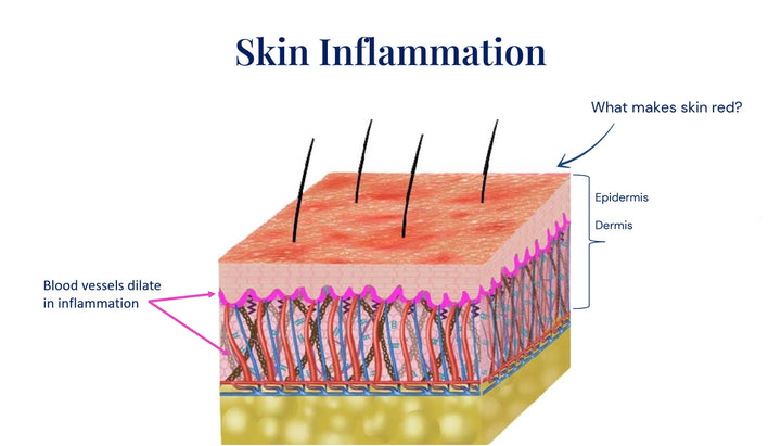 Skin inflammation above the skin layers