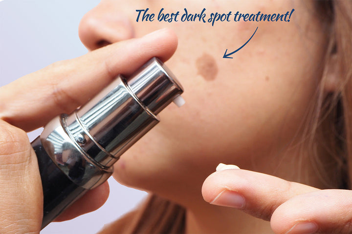 The best dark spot treatments