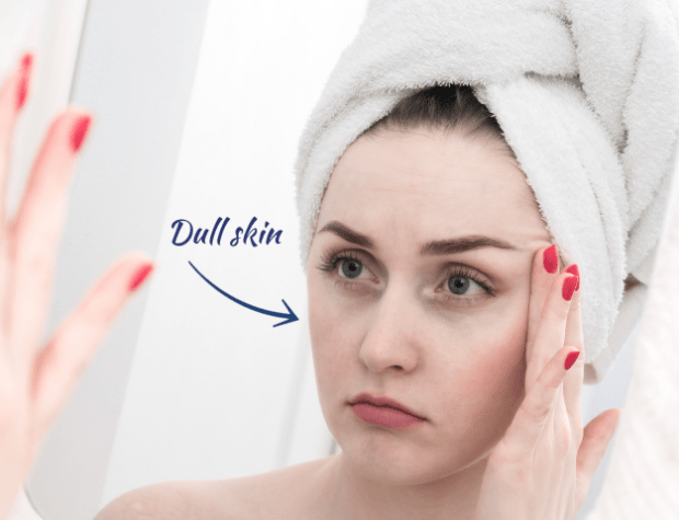 Dull, dry skin