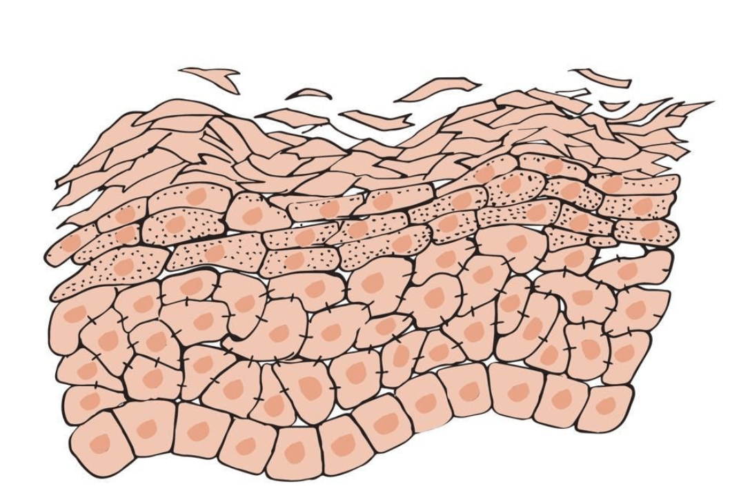 glass skin