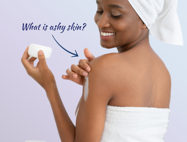 What is ashy skin?