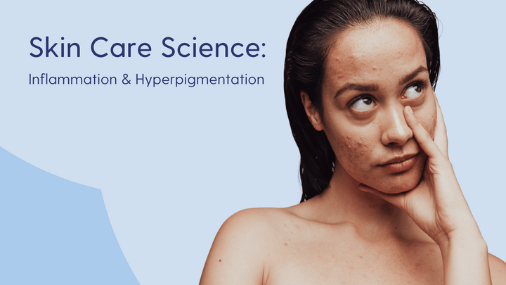 Post inflammatory hyperpigmentation