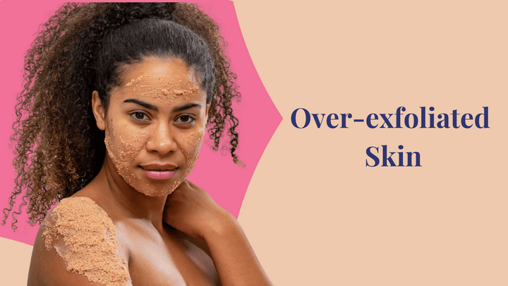 Over exfoliated skin