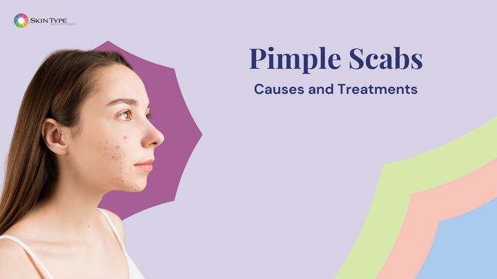 pimple scabs