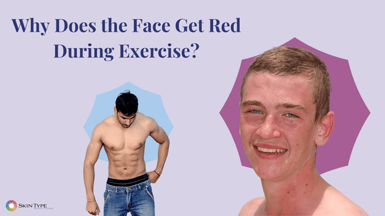 Exercise