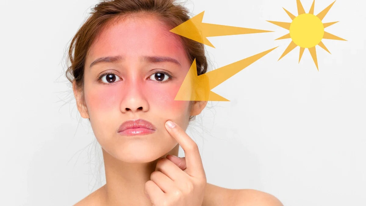 Retinol Sun Sensitivity and Photosensitivity – Skin Type Solutions